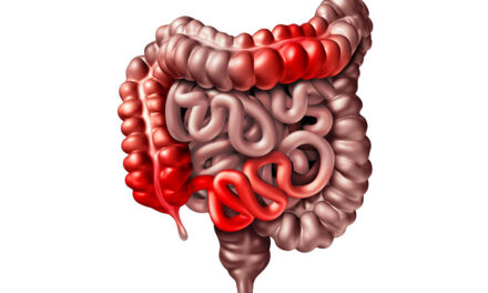 Role of Genetics in Gastrointestinal Diseases