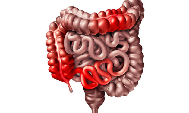 Role of Genetics in Gastrointestinal Diseases