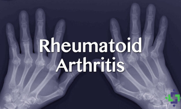 Rheumatoid Arthritis (RA)